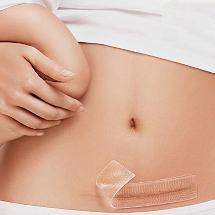 Silicone Scar Therapy Gel Patch